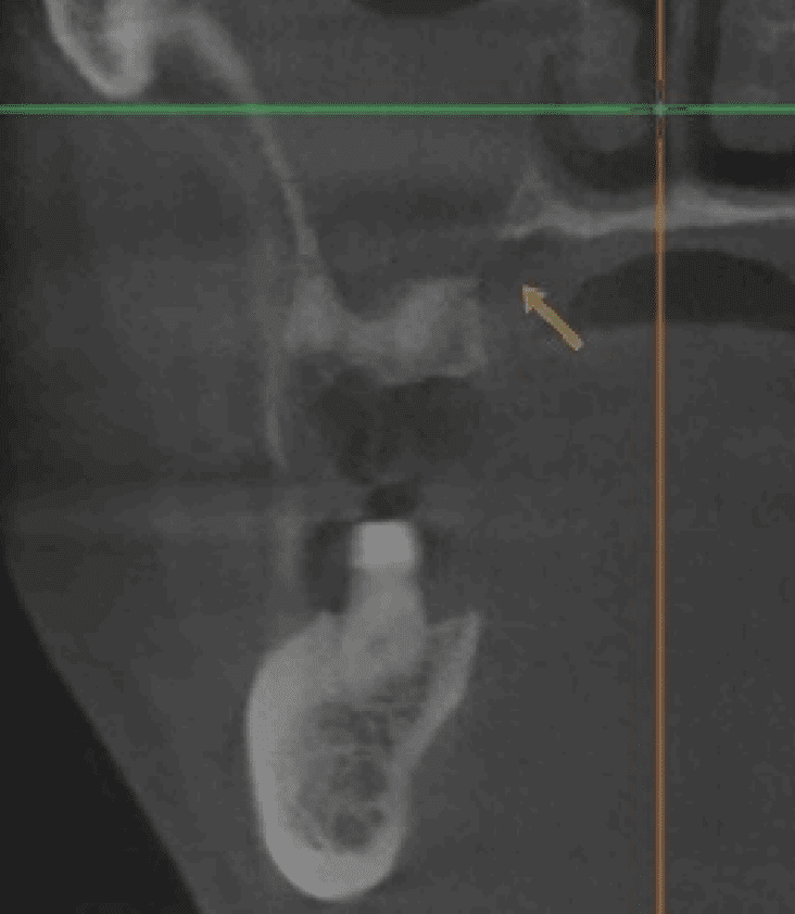 Photo 2 clinical presentation