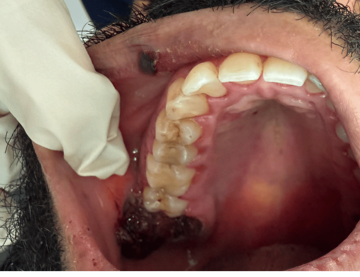 Photo 3 clinical presentation