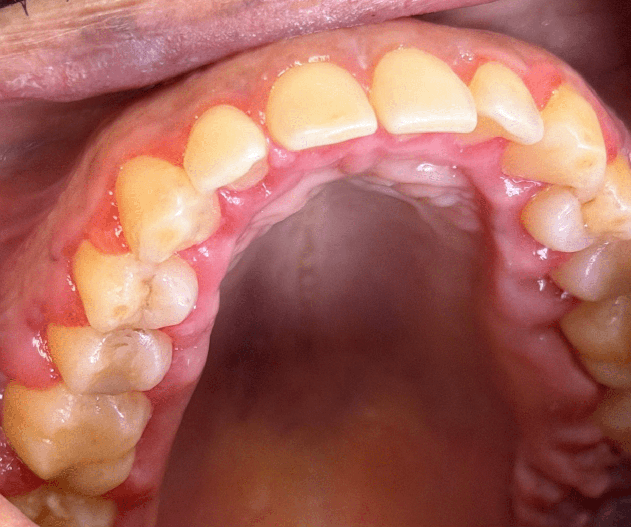 Photo 4 clinical presentation