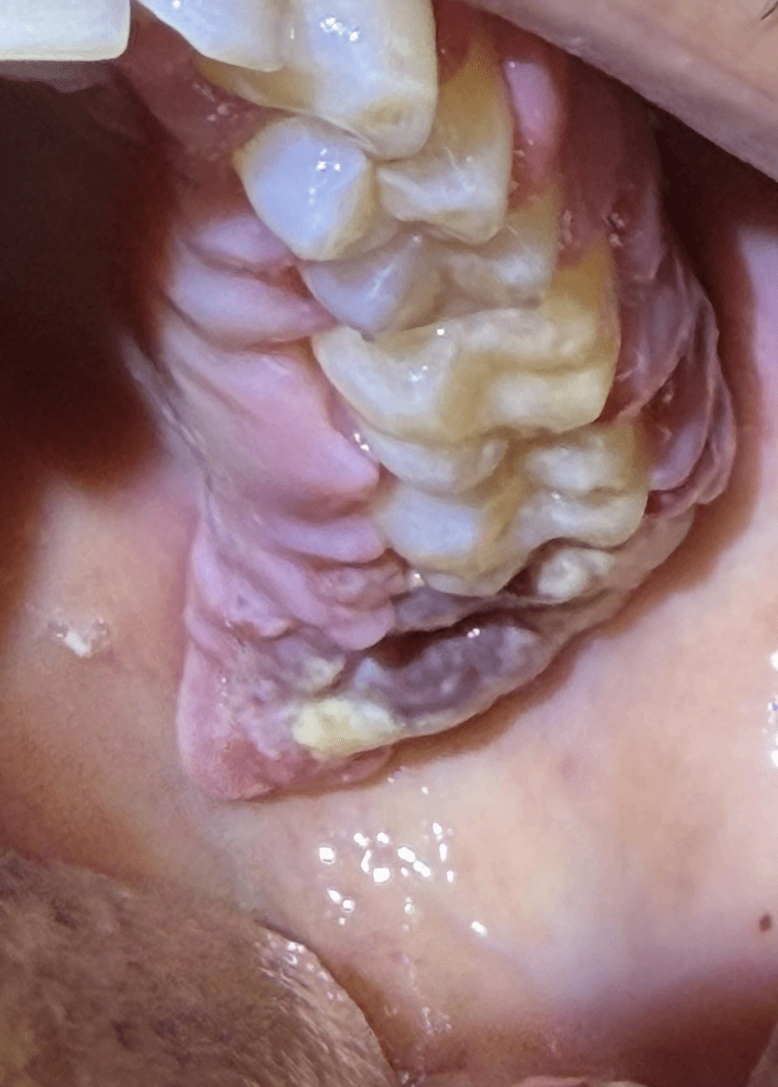 Photo 5 clinical presentation