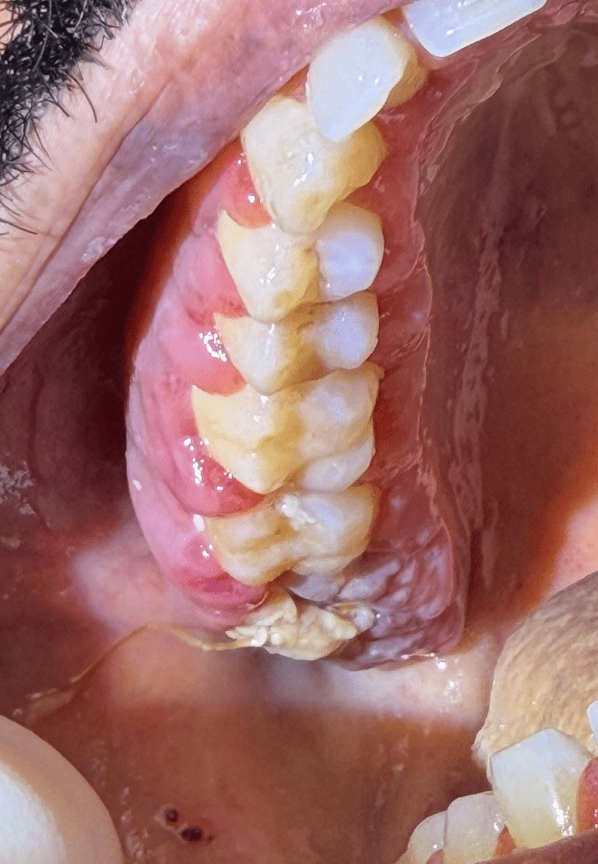 Photo 6 clinical presentation